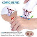 Aparelho Para Limpeza Facial – 6 Benefícios em 1