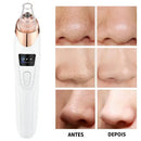 Aparelho Para Limpeza Facial – 6 Benefícios em 1