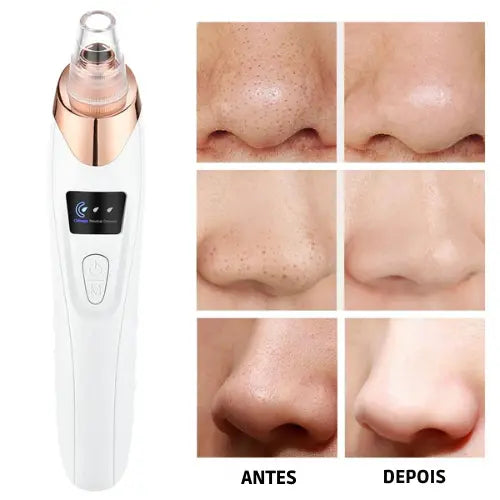 Aparelho Para Limpeza Facial – 6 Benefícios em 1