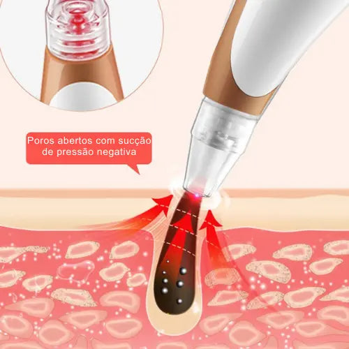 Aparelho Para Limpeza Facial – 6 Benefícios em 1